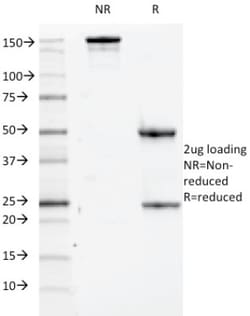 CD84/SLAMF5 Antibody (152-1D5), Novus Biologicals:Antibodies:Primary Antibodies